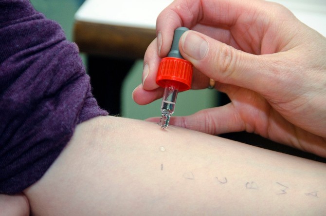 Ispitivanje alergije na hranu podrazumeva kožno testiranje (standardnim komercijanim alergenima ili svežim namirnicama – prik ili prik to prik testiranje, aplikacija patch testa), in vitro – određivanje specifičnih IgE antitela i provokaciju suspektnom hranom