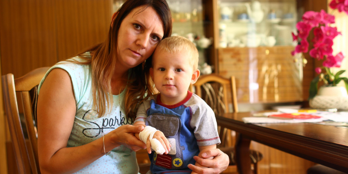 2-letni Szymon doznał poważnego urazu palca