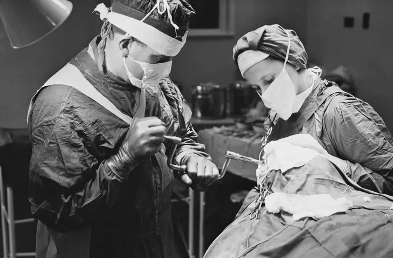 Chirurg przed wykonaniem lobotomii, w szpitalu psychiatrycznym w Anglii, używa w wiertła do wiercenia otworów w czaszce pacjenta, listopad 1946/ Getty Images)