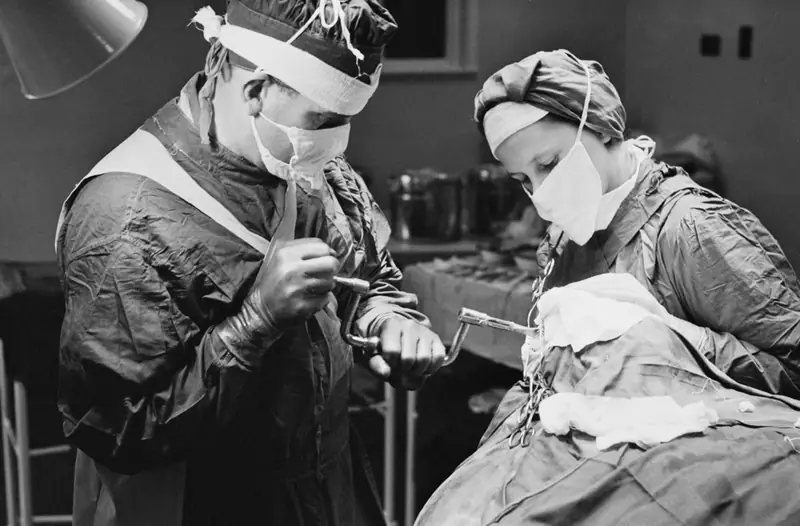 Chirurg przed wykonaniem lobotomii, w szpitalu psychiatrycznym w Anglii, używa w wiertła do wiercenia otworów w czaszce pacjenta, listopad 1946/ Getty Images)