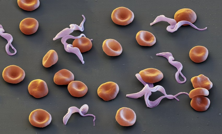 Parazit bolesti spavanja