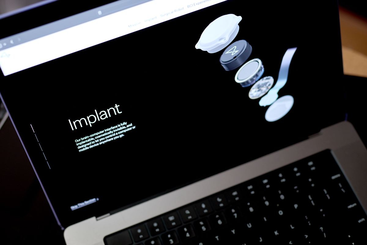 Implant od Neuralink pozwoli na sterowanie ramieniem robota za pomocą myśli, zdj. Gabby Jones