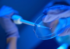  Muška neplodnost je u stalnom porastu