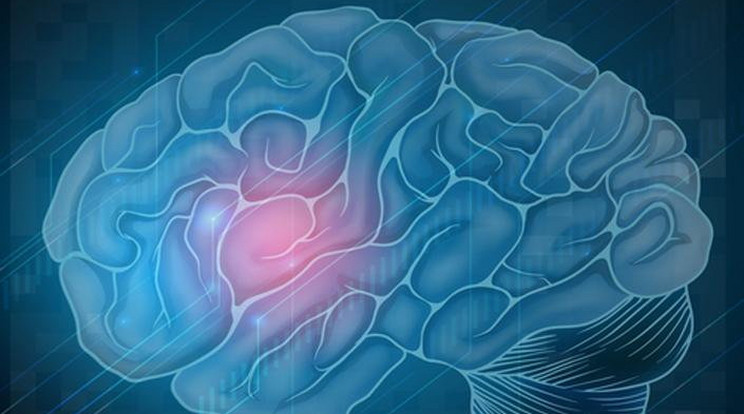 Online tanítják a stroke tüneteinek felismerését a Semmelweis Egyetem orvosai /Forrás: Northfoto/