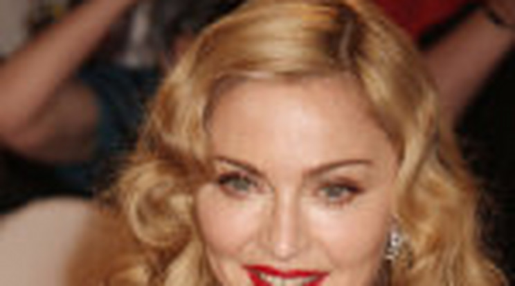 Madonna imádja, ha fémszálakat ültetnek belé