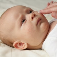 Gyermeke atópiás ekcémával küzd? Így kezelheti a kellemetlen bőrbetegséget!