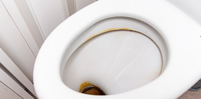 Używasz tego popularnego produktu do sprzątania toalety? Lepiej przestań, bo będziesz musieć zrobić remont