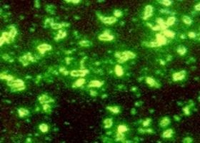 bakterium-yersinia-pestis-d00000D72922895497514