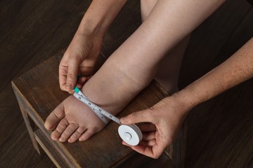 Vizesedik, felpüffedt a lába? Ekkor jelez nyiroködémát