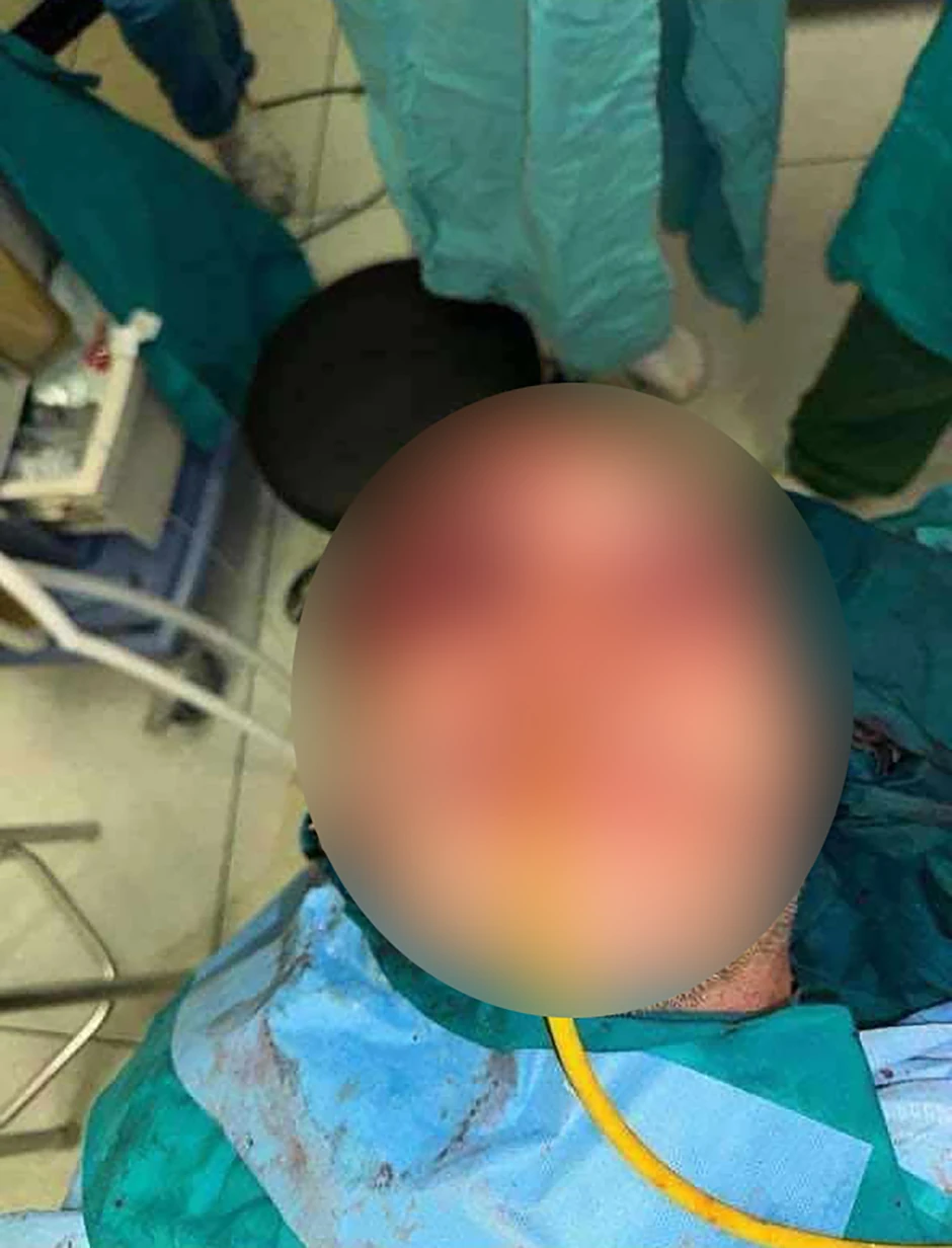 Lovočuvar kojeg je napala mečka