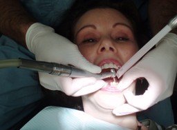 skarbówka potwierdza: leczenie zębów bez odliczeń w ramach ulgi rehabilitacyjnej