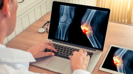 Joint pain and electronic visit to the rheumatologist.  When is it appropriate to decide on research?