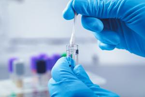 Testy DNA na pochodzenie i ryzyko choroby - czy warto je robić?