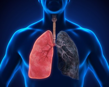 Megdöbbentően gyorsan eljuthatunk az első slukktól a COPD betegségig