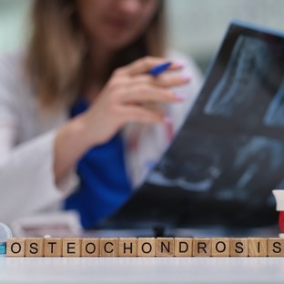 Oszteokondróma: tünetek, vizsgálatok és kezelési lehetőségek