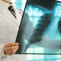 Szúró, mellkasi fájdalom levegővételkor: ezt is jelezheti
