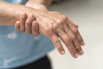 Mit jelez a reggeli kézmerevség? Ez a reumatológus szakorvos válasza