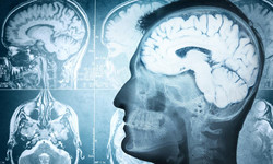 Uzależnienie to choroba mózgu - nowa definicja nałogów