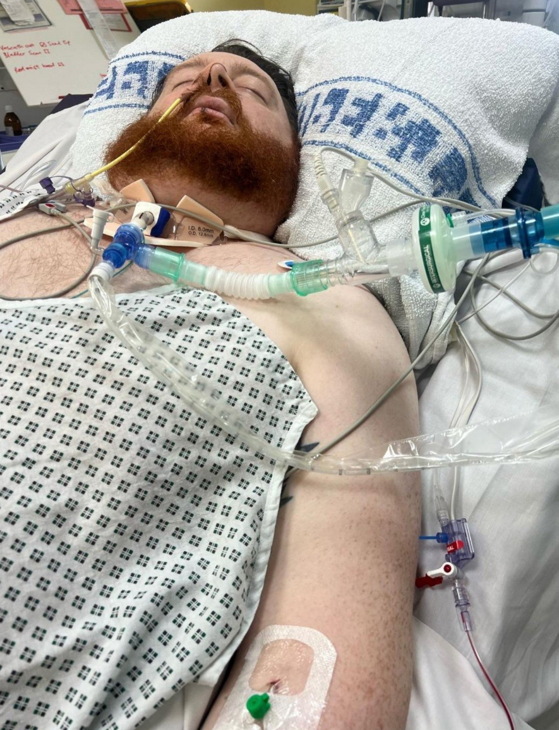 Keith kvôli chorobe stratil schopnosť hýbať rukami a nohami.