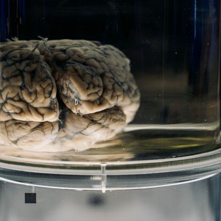 Hetven éve darabokra vágták – most kínai tudósok vizsgálnák Einstein feldarabolt agyát