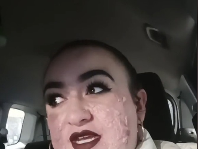 Ona je rešila svoju priču da deli i tako pruži podršku mnogima koji pate od istog stanja