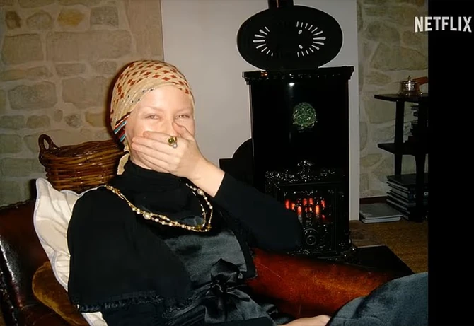 Kajli Minog krila od celog sveta da je imala drugi rak 