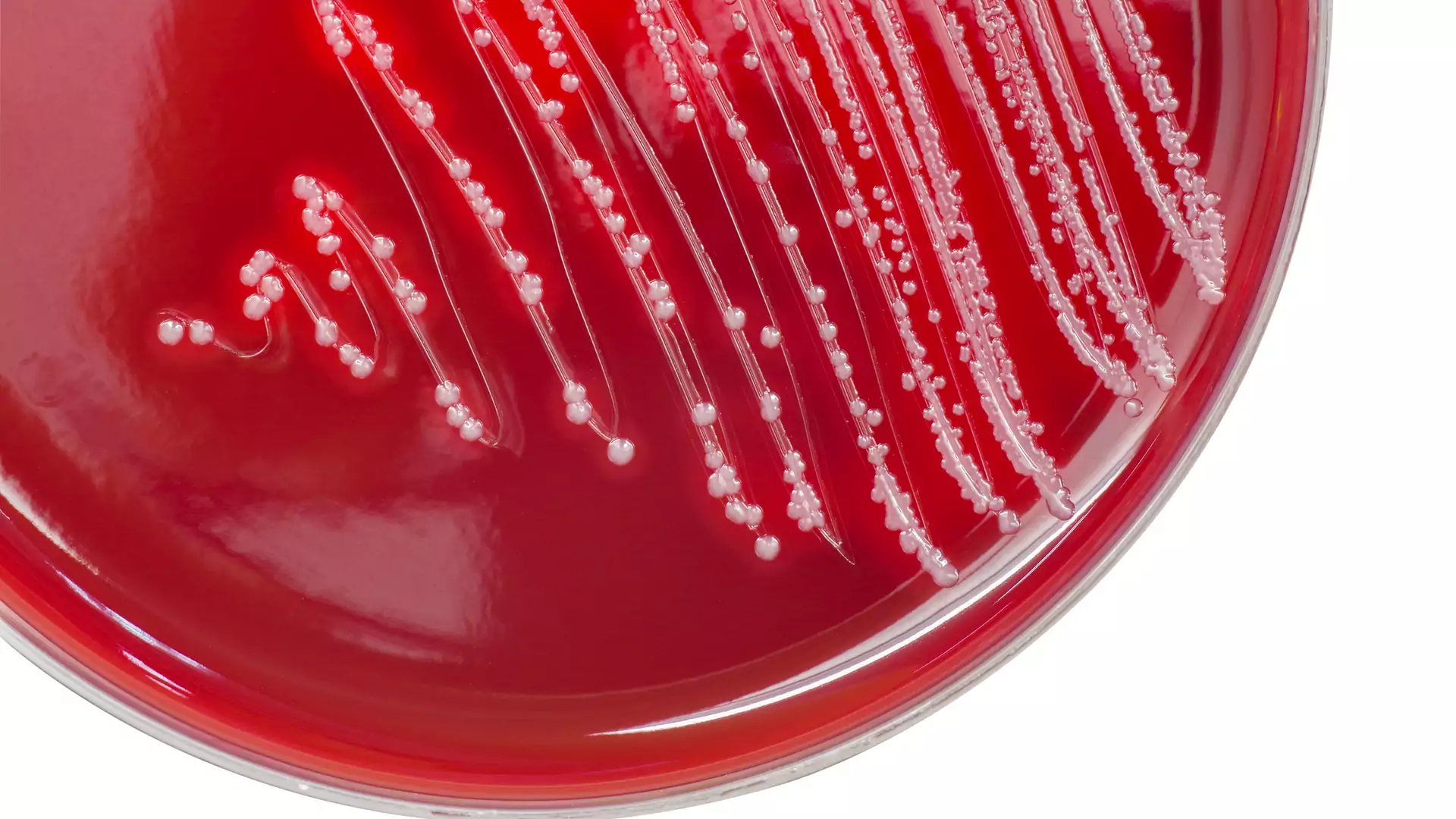 Paciorkowiec – bakteria powodująca poważne konsekwencje