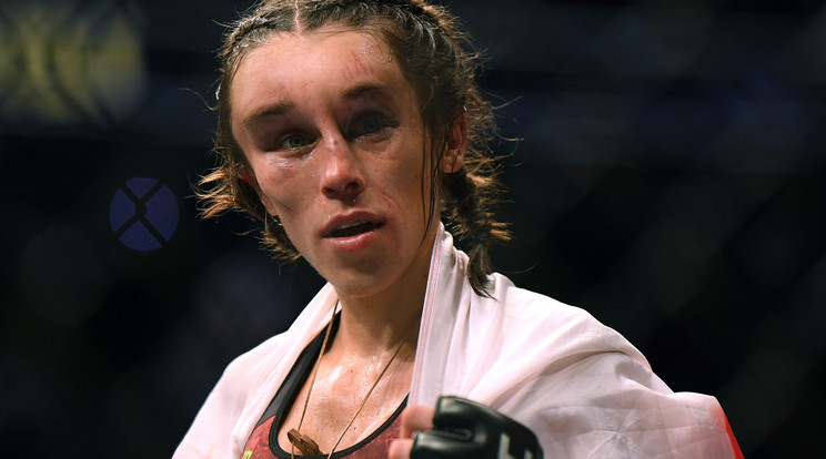 Joanna Jedrzejczyk arca eldeformálódott, de most már jól van / Fotó: Getty Images 