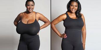 How a Breast Reduction Can Help Women Who Are Active and Those Who Want to  Be Active