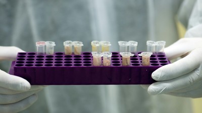 Facts about DNA tests on an unborn baby 