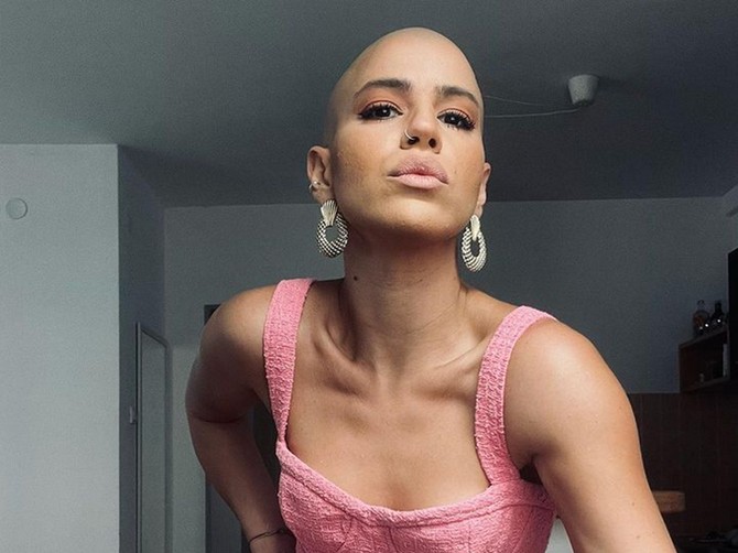 Sonja Milosavljević je zbog alopecije obrijala glavu, a muškarcima je prava egzotika