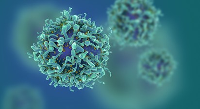 Korai stádiumban is kimutatható lesz a daganatos elváltozás - új magyar diagnosztikai eljárást fejlesztenek