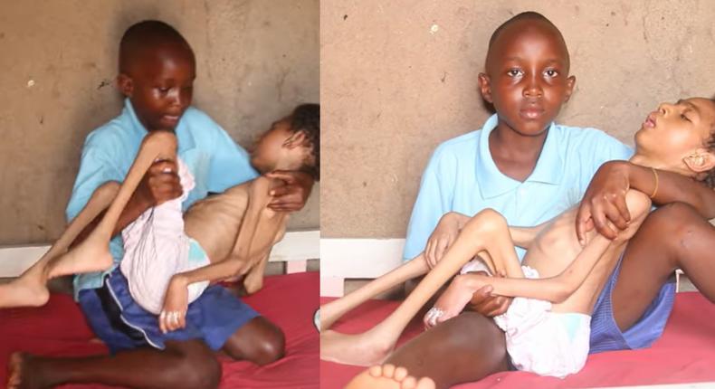 Help my twin brother get treatment – 12-year-old girl (video)