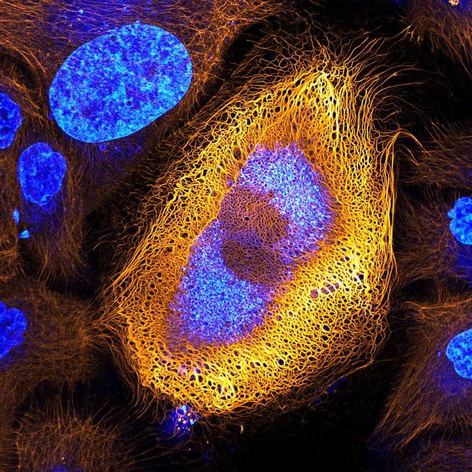 To zdjęcie zdobyło pierwsze miejsce w konkursie. Pokazuje struktury keratynowe w "unieśmiertelnionych" komórkach skóry człowieka. Takie komórki to bardzo ważne narzędzia w badaniach naukowych.