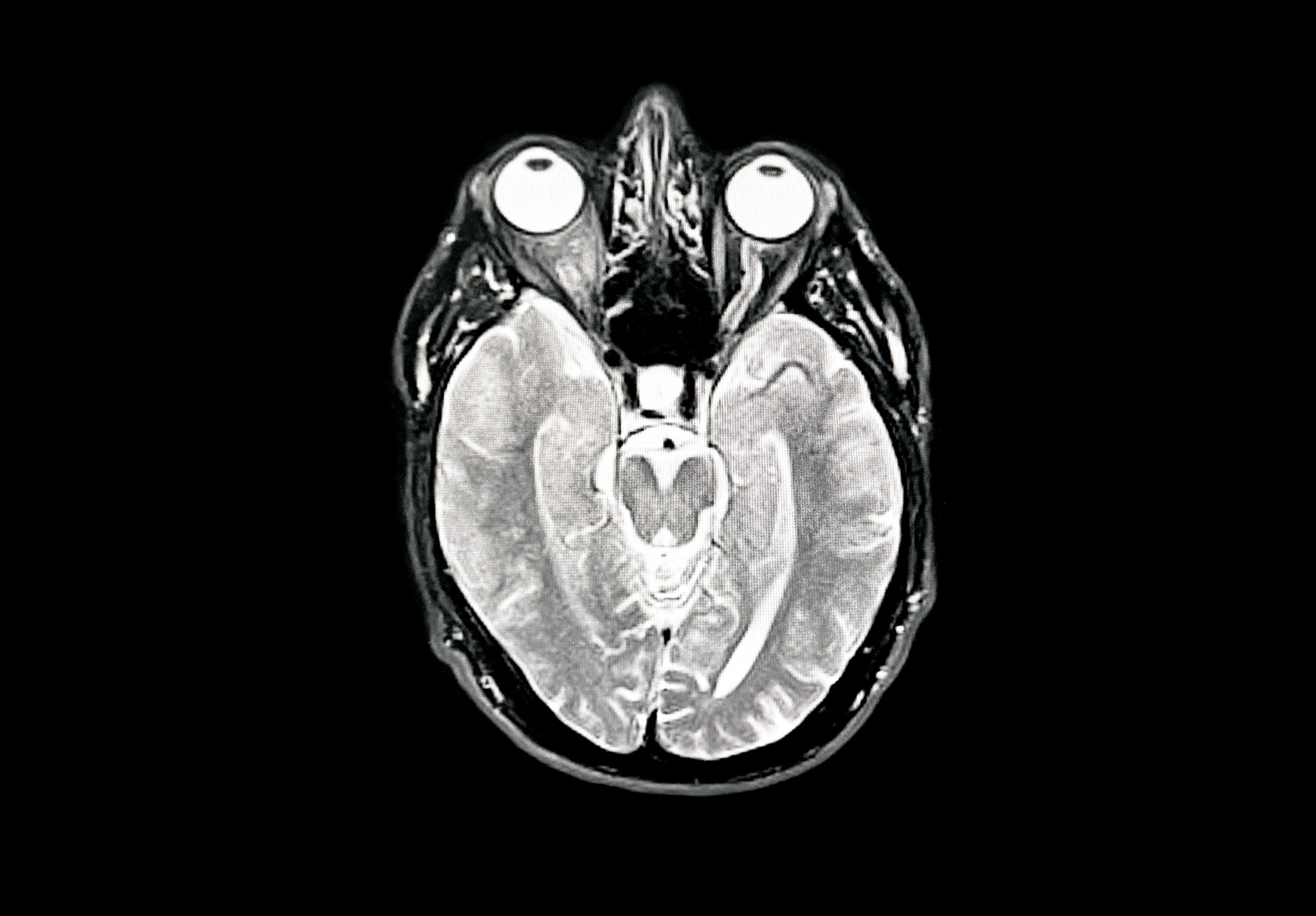 Pareidolia: studio rivela come cervello vede volti ovunque