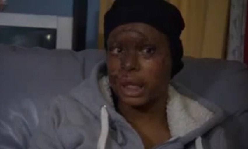 Naomi Oni posle napada