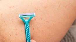 Zapalenie mieszków włosowych - czym jest, leczenie, zapobieganie, kosmetyki