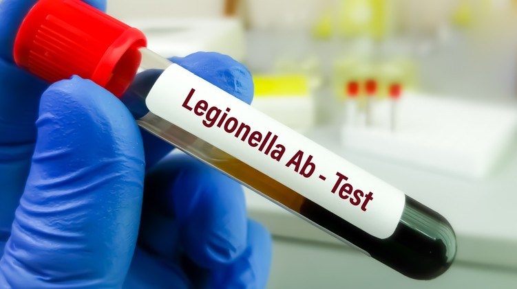 Legionárius betegség, legionellosis oka tönet kezelés
