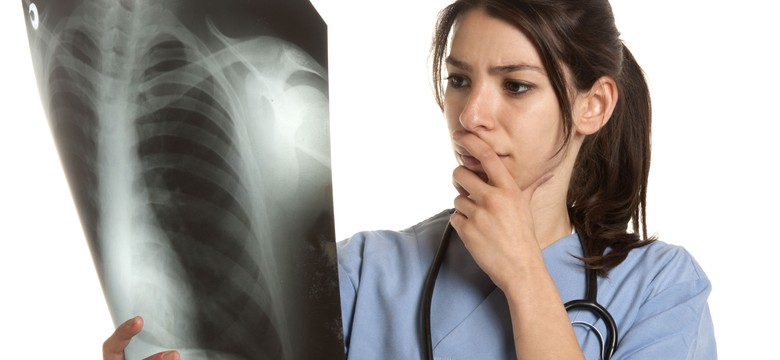 Zobacz, gdzie bijemy rekordy w gruźlicy