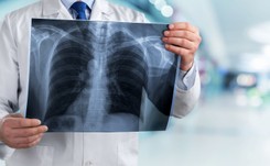 Co drugi badany Polak nie wykonuje badań profilaktycznych w kierunku raka