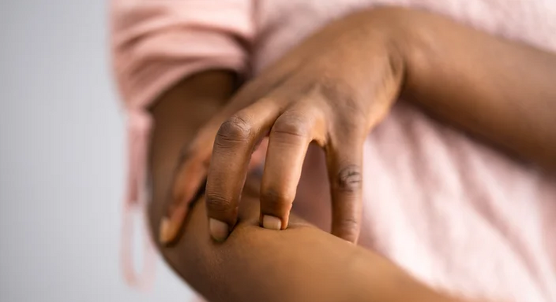 This is why your body itches after a bath[GettyImages]