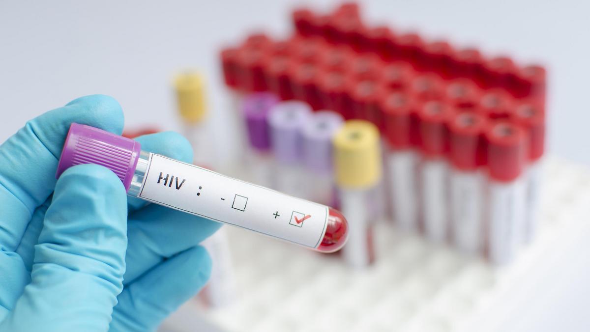 HIV AIDS zdrowie seks choroby