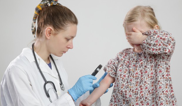 Atopijski dermatitis ima svako peto dete u Srbiji 