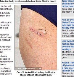 Lindsay Lohan zamiast ciała pokazuje blizny