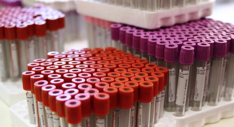 The World Anti-Doping Agency is to discuss the creation of a new, independent drug-testing authority