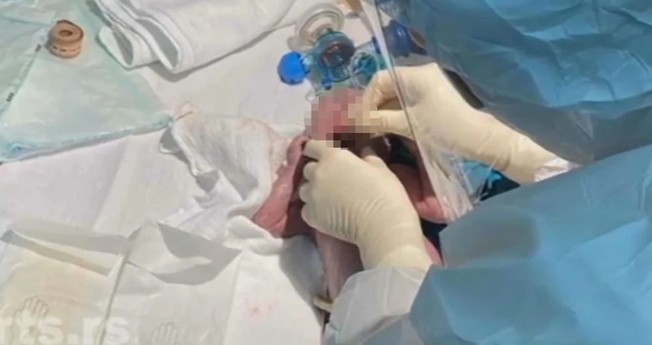 Luka se rodio sa dva kilograma i 260 grama