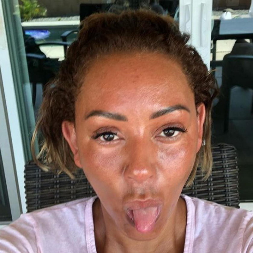 Melanie Brown, Mel B 