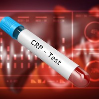 Rejtett gyulladás a szervezetben: ezek a túl magas CRP-szint tünetei