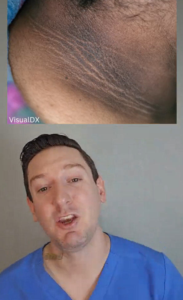 Škvrny sa môžu objaviť kdekoľvek na tele.