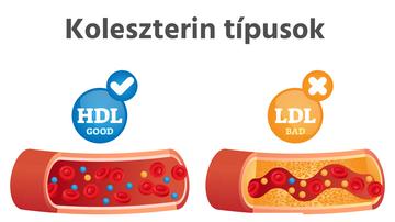 hogy a koleszterin hogyan befolyásolja a látást)
